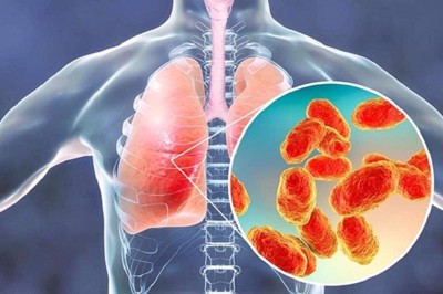Những mối nguy tiềm ẩn từ căn bệnh viêm phổi không phải ai cũng biết